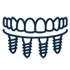 All-on-X Dental Implants (also referred to as All-on-4 or All-on-6)