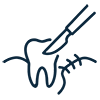 Dentoalveolar Surgery