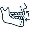 Orthognathic (Corrective Jaw) Surgery